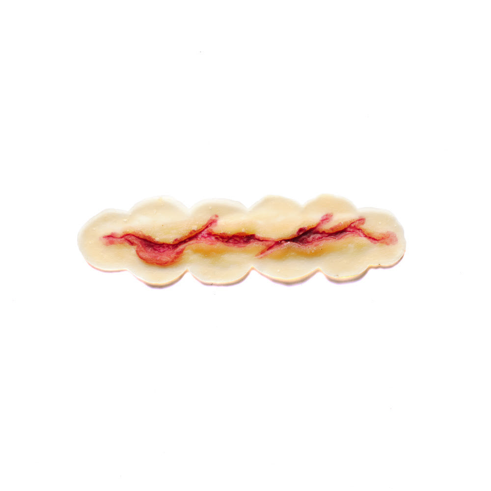 Prosthetic, 4" Laceration