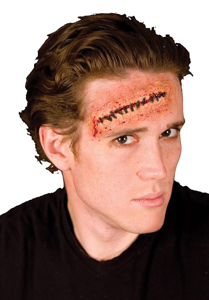 Wound, Woochie Stitches